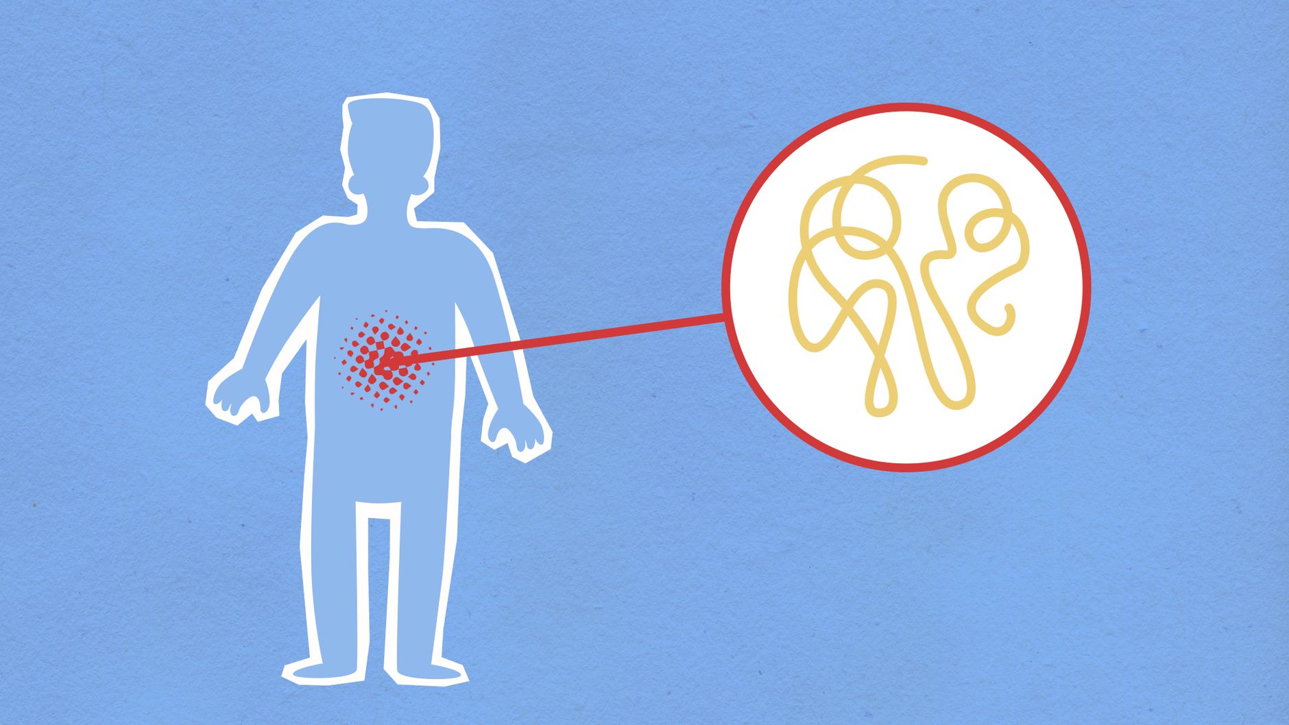Can Fasting Heal Your Gut? What The Experts Say